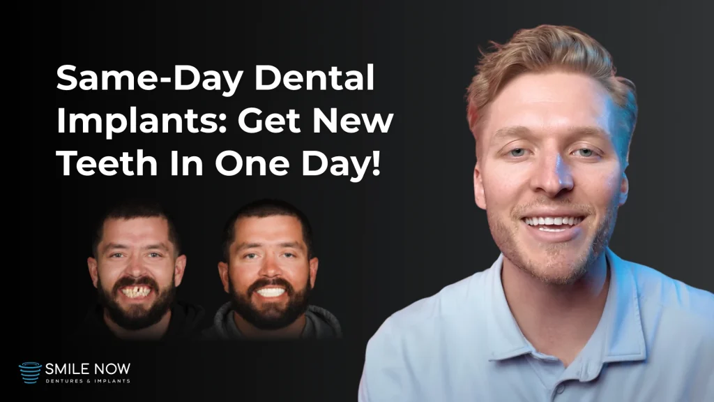 Video thumbnail for same day dental implants at Smile Now