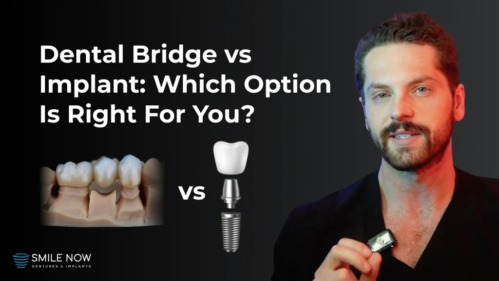 Thumbnail for a video comparing a dental bridge vs implant
