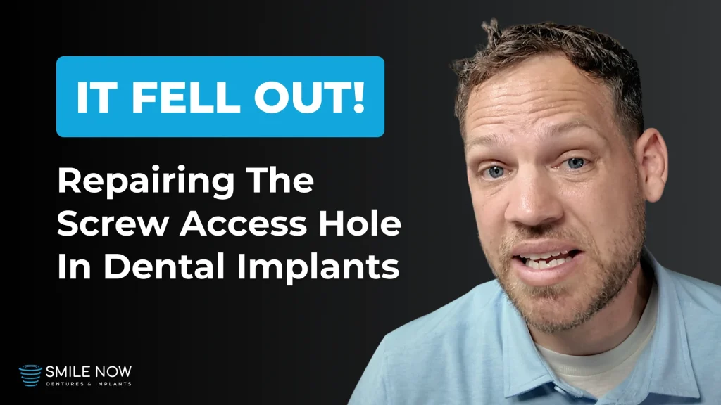 Thumbnail for a video about Professional Dental Implant Repair: What To Do If The Screw Access Hole Filling Falls Out