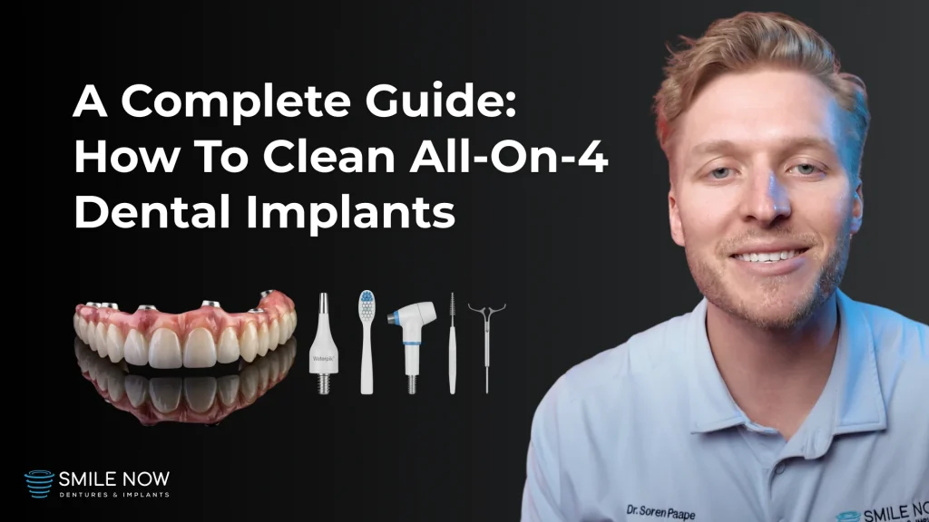 Video thumbnail for how to clean all on 4 dental implants