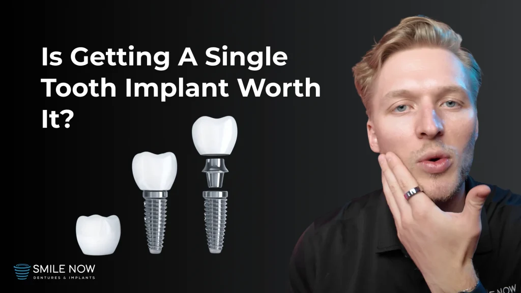 Thumbnail for a video that answers the question "Is a single tooth implant worth it?"