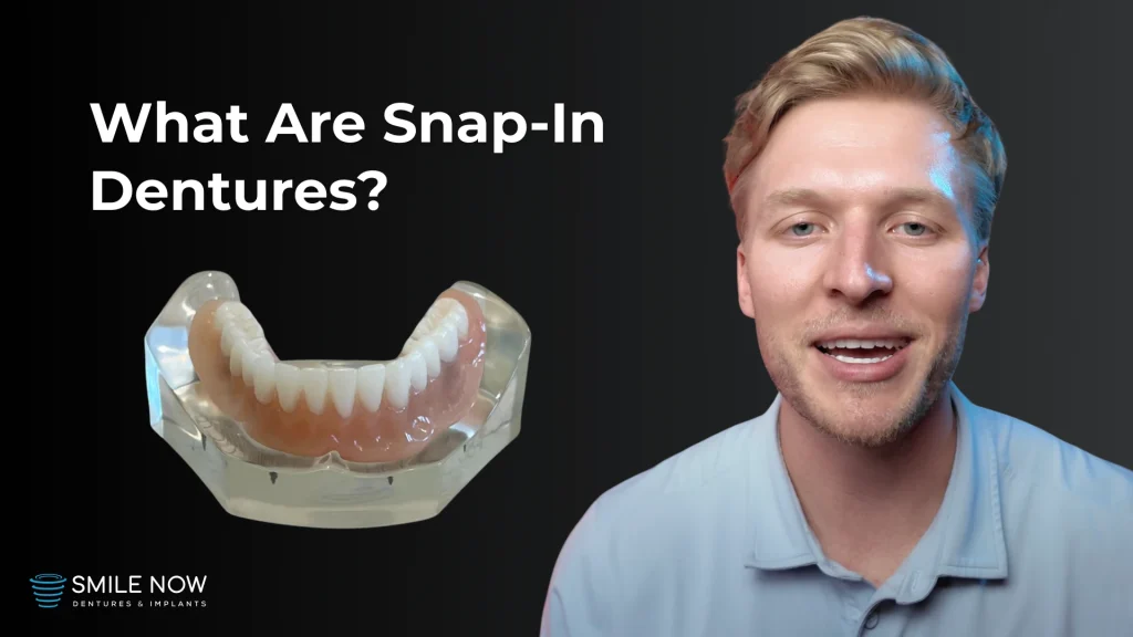 Thumbnail for a video about snap in dentures, including an overview of the process, benefits, and recovery timeline.