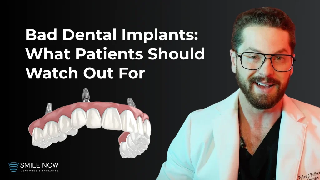 Thumbnail for a video about bad dental implants, the red flags patients should watch out for, and the crucial questions to ask their provider.