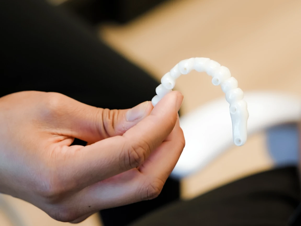 What do dental implants feel like? Just like natural teeth with an FP1 zirconia bridge.