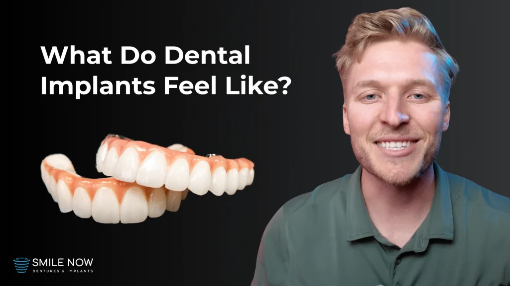 Thumbnail for a video that answers the question "what do dental implants feel like after a week, a month, and a year?"